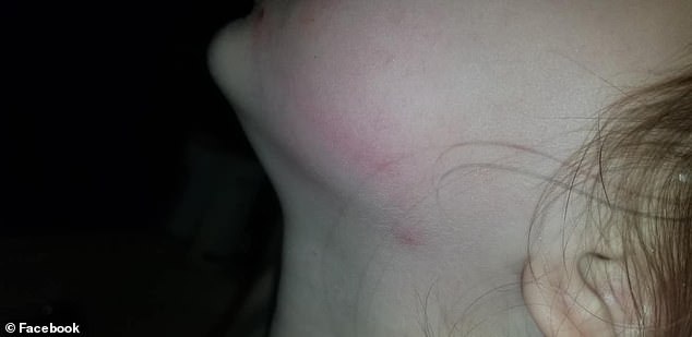 5歲的女孩臉上滿是瘀傷，原來(lái)在校車(chē)上被毆打了45分鐘