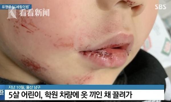 5歲女孩下校車時(shí)被門夾住 司機(jī)沒(méi)注意繼續(xù)拖行